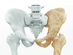 OsteoZinc Plus -PROFILAXIA ȘI TRATAMENTUL COMPLEX AL OSTEOPOROZEI